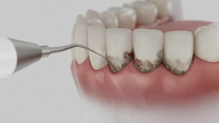 Reliable Dental contractor in Start, LA by Smile Center Dentistry